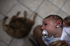 Mazulis, kurš pirms dzimšanas bija inficēts ar Zikas vīrusu
