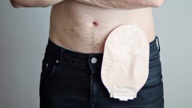 Lai atgrieztos aktīvā dzīvē... Cilvēkiem ar stomu vajadzīgs lielāks valsts atbalsts