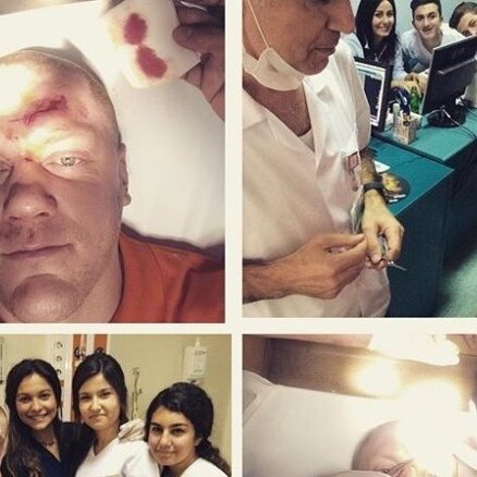 Kaspars Kambala nonācis slimnīcā ar apskādētu seju