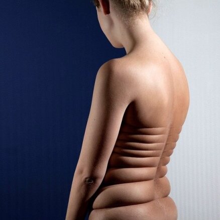 Mākslas projekts: Fotogrāfe šķietami pārveido ķermeņus
