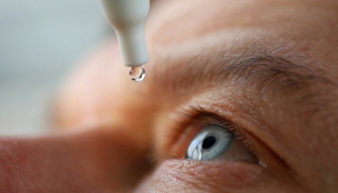 Glaukomas agrīnie simptomi un iespējas slimību apturēt