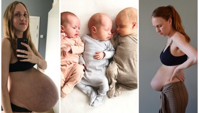 Drosmīgas fotogrāfijas, kurās trīnīšu mamma atklāj ķermeņa izmaiņas pēc dzemdībām