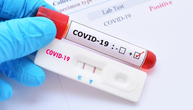 Svētdien konstatēti 3616 jauni Covid-19 infekcijas gadījumi; deviņi cilvēki miruši