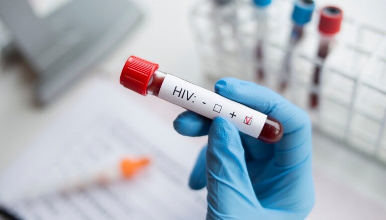 Роспотребнадзор: у 1,5 млн россиян положительный тест на ВИЧ