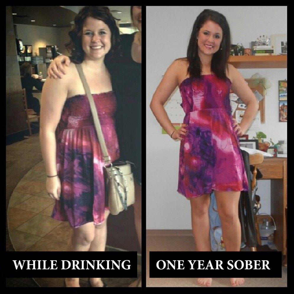 Девушки до и после алкоголизма